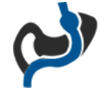 Gastric Bypass