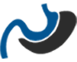 Gastric Sleeve